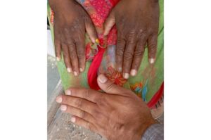 skin pithampur mp pollution climate change