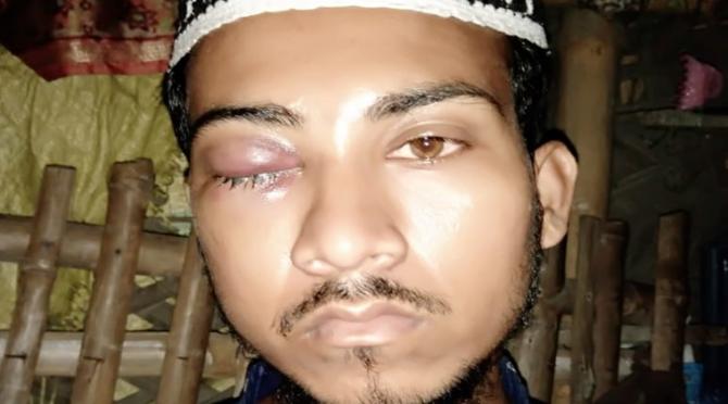 Jai Sri Ram shahrukh haldar Madarsa Skull cap beard